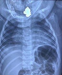 9µġ̽ޡ¸𱦱˽ϵĵ׹