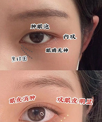 肿眼泡姐妹看过来,分享一个超实用的消肿按摩手法