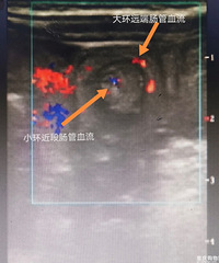 ӿֱ⣬⣬ʹܰҪ飬Ԥ׵