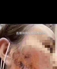 �������㶫�򸾱���ţ�ȫ�ٻ�����������𣿺�����