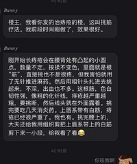 一个治痔疮的方法,我再次感叹中医的神奇!