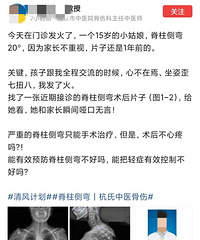 现在很多小孩脊柱侧弯吗?好多都是因为家长不重视坐姿导致的