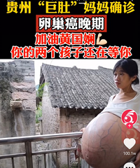 你们看了贵州那个“巨肚”妈妈没?确诊是卵巢癌晚期,好黑人