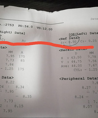 真的没想通,娃儿裸眼验光正常,仪器检查却是假性近视300多度