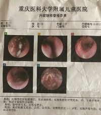 娃儿过敏性鼻炎跑了儿童医院无数次,现在一岁半,每天睡觉鼻塞