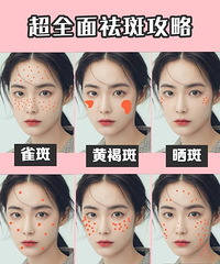 你长斑了吗?盘点这几类斑的形成原因和保养方式!