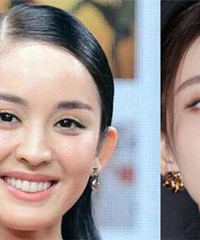 娜扎的变美过程太厉害了吧,多图对比她脸上动了哪些地方