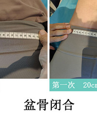 揭秘产后全手法徒手矫正,不用任何仪器,就能解决产后一系列问题