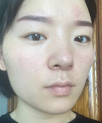 纹眉后眉毛变红变蓝怎么办?不用洗眉也有救,亲测有效