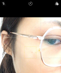 ҲȥĳҽԺƤ⣬ԭô鷳