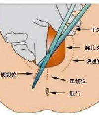 Ϲæϴ˿ں󣬵µڶԸ