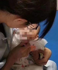 重庆五院捡到一名弃婴,因为出生唇腭裂,被父母遗弃在南山上