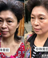 同事做微商卖珍珠膏,3个月赚10万,这种智商税真的有人交吗?