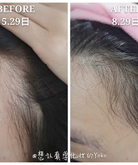 戴上帽子就能生发!新型智商税?