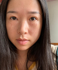 不到一小时就完成的祛斑,不敢相信效果居然是这样的……