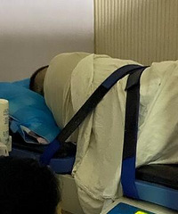 结石发病有多痛?医生说比生孩子痛