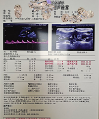大排畸没过,胎儿双足内翻,到底该不该留?