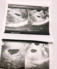 ��һ�����¾��ܼ��棬��ȴ��Զʧȥ�㣡