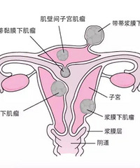 分享改善月经不调的经验