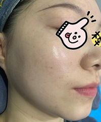 这99元值了!终于知道为什么我变成了敏感肌,还享受了一次按摩