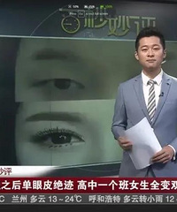 你会带自己的小孩去整容吗?有孩子才7岁,被亲妈带去割了双眼皮