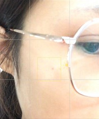 ҲȥҽԺƤ⣬ԭǰҪ˽ô