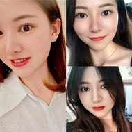 内双肿泡眼的逆袭