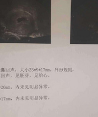 һ̥ͣοңҵıʲôʱң