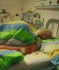 可怕,男子见义勇为结果被猴子群殴致住院,网友:还有被推下山的