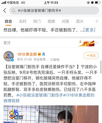 小伙子被浴室玻璃门割伤手,是自爆还是操作不当?