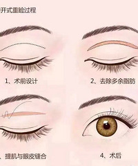 ��˫��Ƥ������ѡ��ȫ�л������ߣ�����˵˵��ȱ��