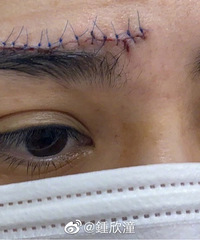 �찡����������˿ںó�һ���ڰ�