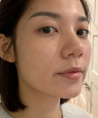 不黑不吹,水光针的效果怎么样?