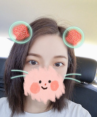 双眼皮的我去做了全切+开眼角,现在双眼好有神