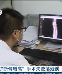 被中国明文禁止的「断骨增高术」:技术没有善恶,但人有