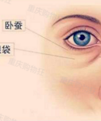 实用科普!眼袋分为很多种,但消灭眼袋的方法只有这一种