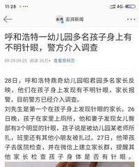又出现幼儿园老师扎学生?!多名孩子身上有不明针眼