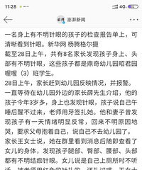 又出现幼儿园老师扎学生?!多名孩子身上有不明针眼