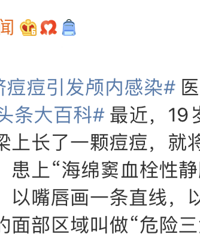 ICU警告:你挤痘痘的样子,像是在玩命!