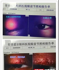 男童长个麦粒肿居然要住院 家长可别大意了