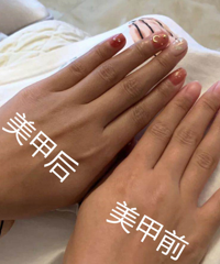 做美甲会让手变黑?看到这个黑黢黢的手我信了