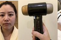 舒适的小颜术和抗糖冻龄术,轻松变小脸变好皮肤