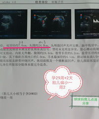 孕29周产检,血糖复查,B超胎儿偏小一周多,医生这样说