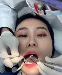 一个资深“烂牙”患者的忠告:看牙要趁早,不然你就会像我这样…