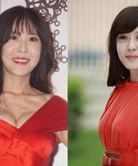 盘点圈内整容失败的明星,卿本佳人,可惜整得面目全非