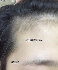 �ѷ������ӿ�������ԭ���������׵�