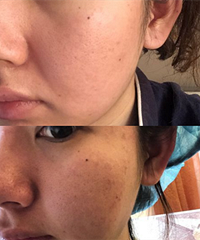 购物狂会员总结!那些做了真正有用的医美项目,贵价护肤品快丢了