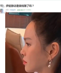 拔草!为什么说不要做线雕?明星都在做的线雕真的不值得吗?