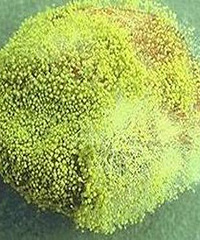 除了自制的“酸汤子”会致命,这些食物也同样是“健康杀手”