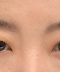 一单一双只做一只的双眼皮,发帖分享更新